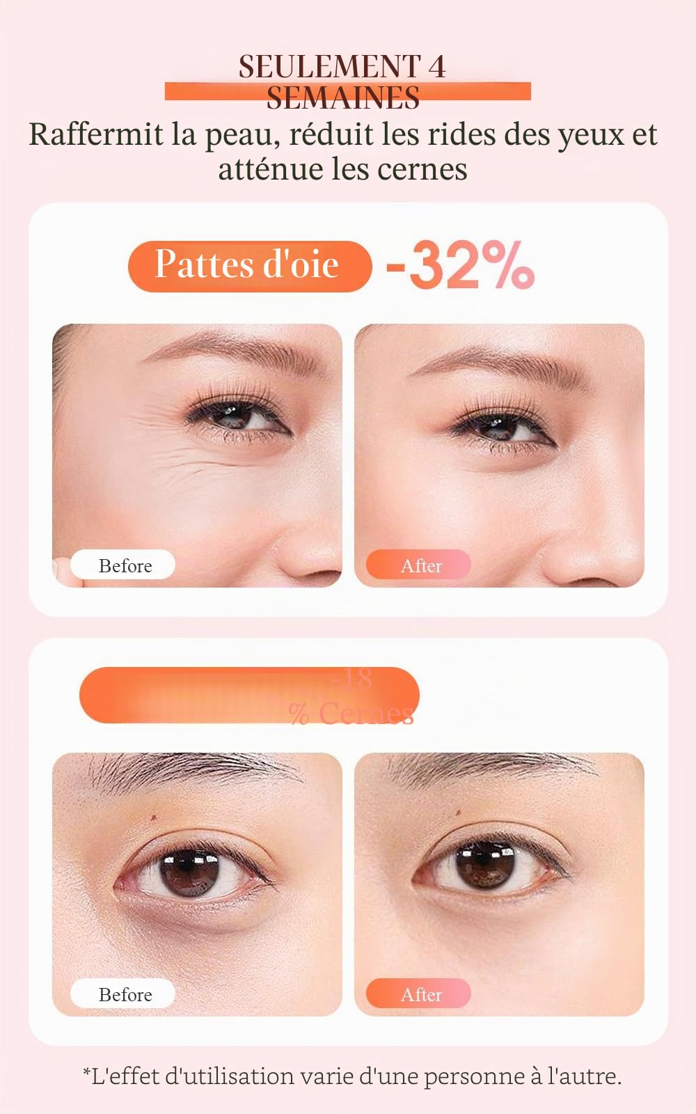 TOUCHBeauty Appareil Massage des Yeux Anti-âge, Masseur Oculaire Anti Rides avec EMS Micro Courant 42℃ Dispositif de Soins Oculaires Chauffant pour les Rides, les Poches et les Cernes AG-1883P(Rose)