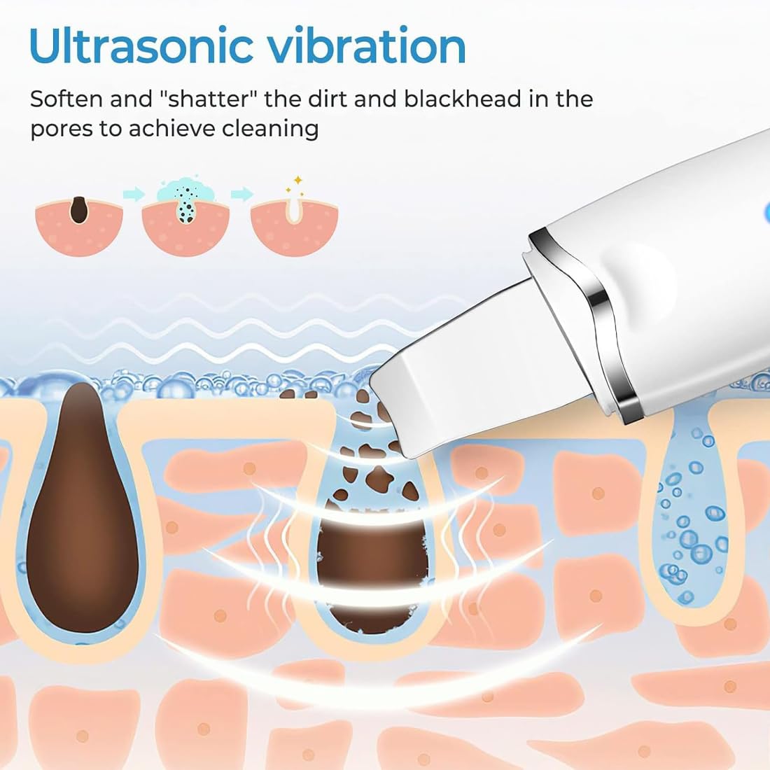 Depurador Ultrasónico De La Piel, Dispositivo Exfoliante, Limpiador Facial Y Removedor De Espinillas, Removedor De Arrugas, Extractor De Comedones Con 3 Modos, Recargable Por USB (Black)