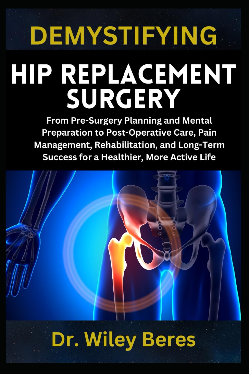 DEMYSTIFYING HIP REPLACEMENT SURGERY: From Pre-Surgery Planning and Mental Preparation to Post-Operative Care, Pain Management, Rehabilitation, and Long-Term Success for a Healthier, More Active Life