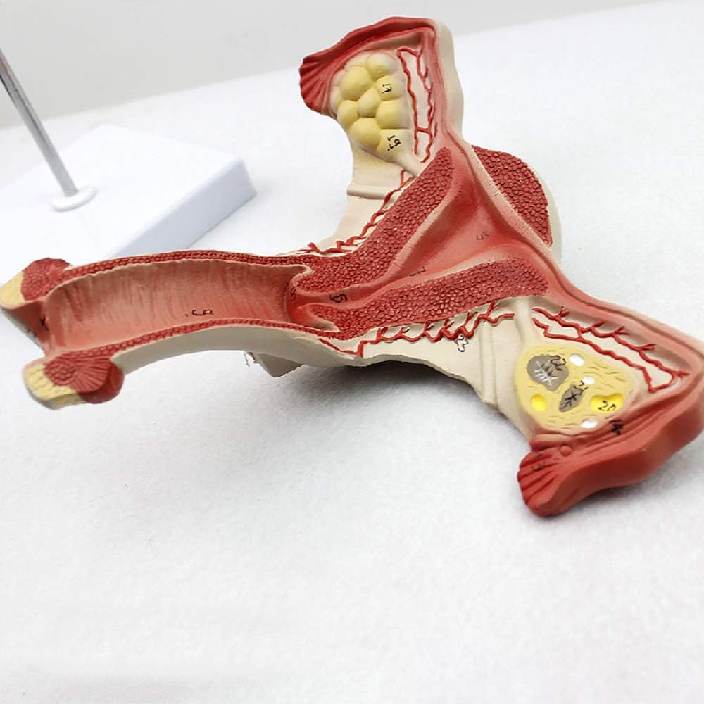 Teaching Model,Uterus Anatomical Model, Female Uterine and Ovarian Disease Model, Uterus and Ovary Reproductive Structure Gynecological Model, Female Internal Reproductiv