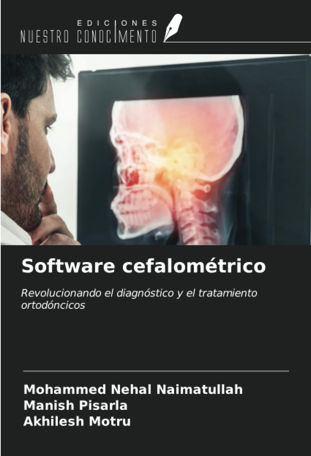 Software cefalométrico: Revolucionando el diagnóstico y el tratamiento ortodóncicos