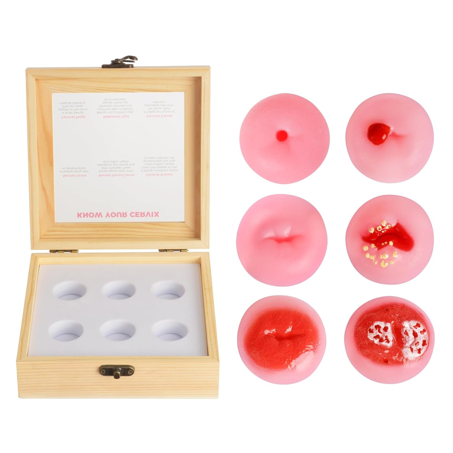 SimCoach Cervix Replicas Model, 6 Cervical Pathology Models for OB/GYN Training & Patient Education, Gynecological Teaching Tool