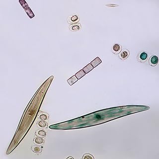 Freshwater and Marine Diatoms Slide, w.m.