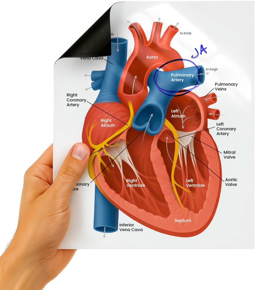 Dry Erase Heart Diagram, 9"x12" Cardiac Anatomy Chart, Doctor & Nurse Patient Education Tool, Sticker, Magnet, Lapboard Options, Wet/Dry Erase Surface (Without Text, Self-Adhesive Backing)