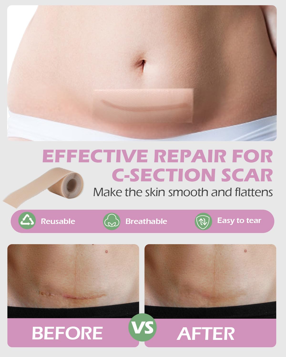Kit imprescindible de recuperación de cesárea: botella Peri, ropa interior de malla desechable, forros de almohadilla de hamamelis, parches de silicona para cicatrices, carpeta abdominal abdominal