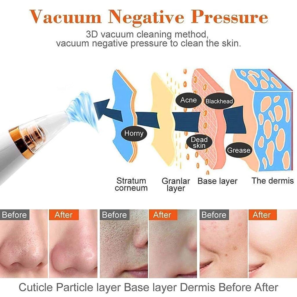NIYANETAIL 6-in-1 Derma Suction Blackhead Remover Machine | Electric Pore Vacuum Cleaner for Face | Rechargeable Skin Care Tool for Women & Men | Personal Facial Cleansing Device 2