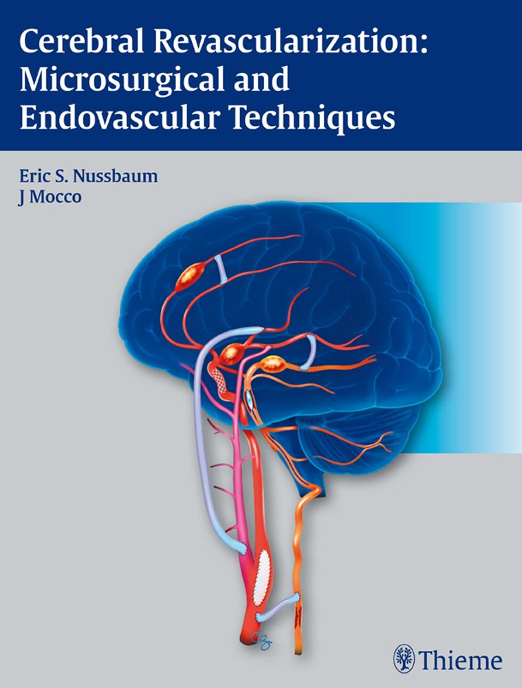 Buy Cerebral Revascularization Microsurgical and Endov: Microsurgical and Endovascular Techniques — BookShops.in