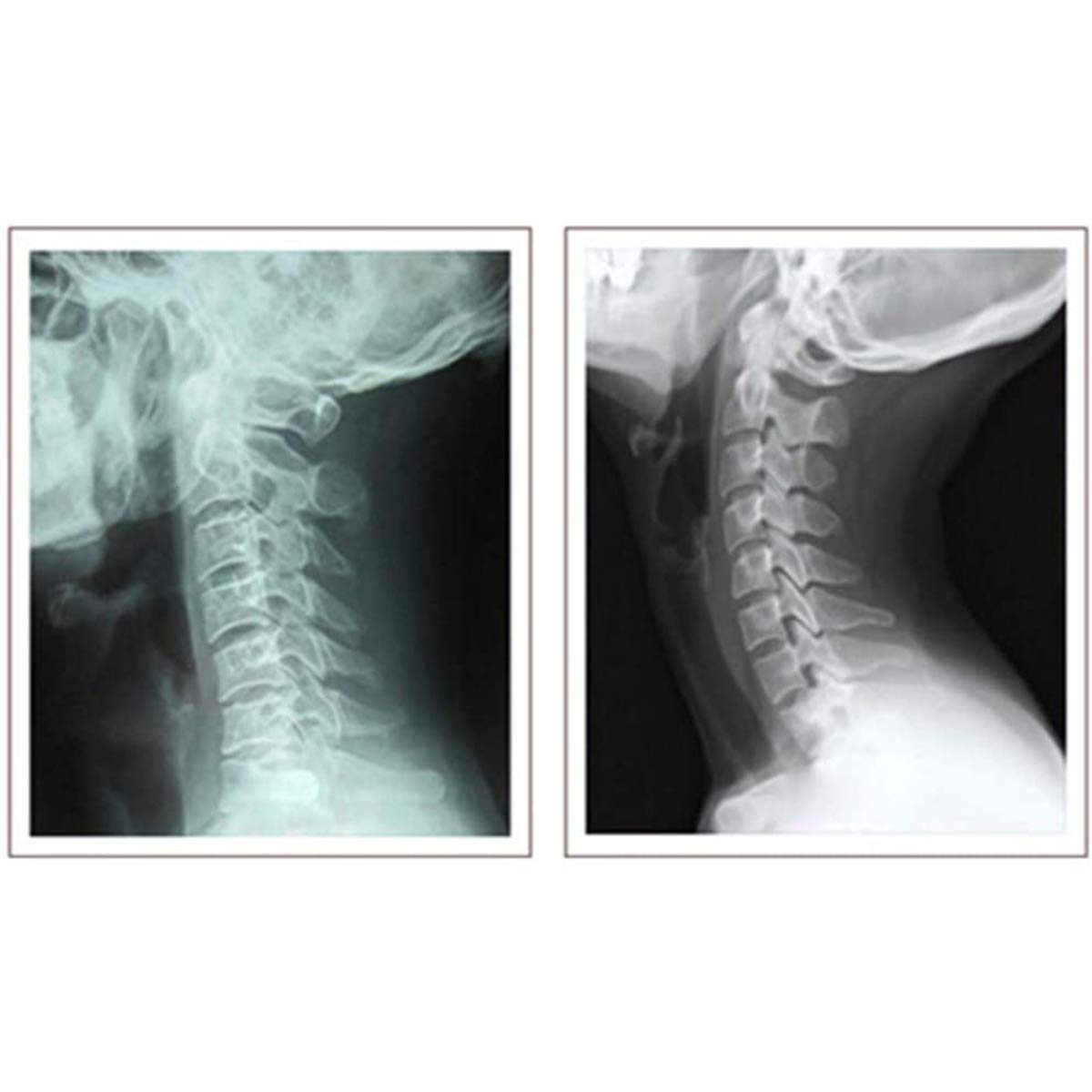 Dispositivo di trazione cervicale per Sollievo dal Dolore al Collo Testa/Spalla sopra Il Telaio della Porta, barella a trazione Aerea Terapia Fisica Domestica per l'artrite,Hanging