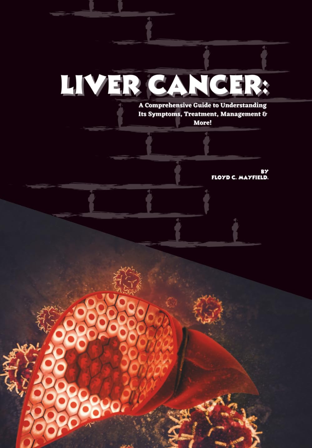 Liver Cancer: A Comprehensive Guide to Understanding Its Symptoms, Treatment, Management & More! (Cancer Decoded)