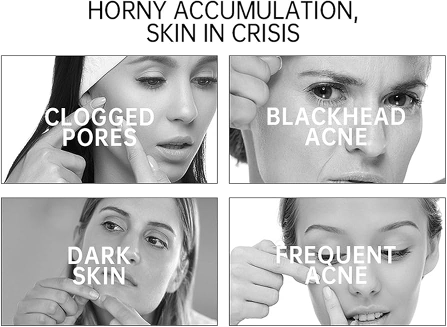 Peeling Off Dead Skin! Clear Peeling Gel? BeautybyjosieK, 42 OFF