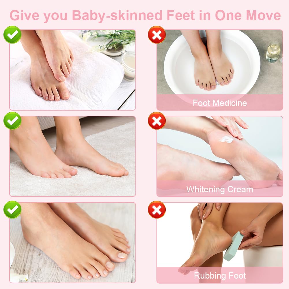 Masque Pieds Peeling Exfoliant, 4 Paires Masque Pieds Hydratant Exfoliant Saveur Rose, Masque Peeling pour les Pieds, Chaussette Exfoliante, pour Nourrissant Callosités, Crevasses et Pieds Secs