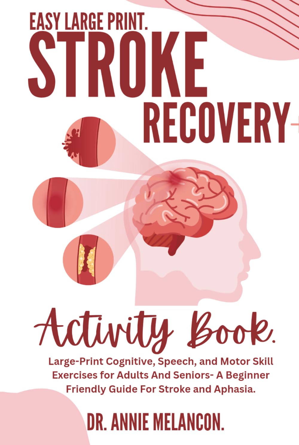 Stroke Recovery Activity Book.: Large-Print Cognitive, Speech, and Motor Skill Exercises for Adults And Seniors- A Beginner Friendly Guide For Stroke and Aphasia.