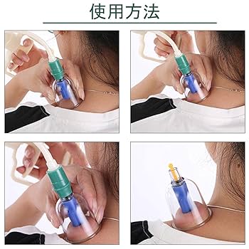 Amazon.co.jp: 32個セット カッピング 吸い玉 真空カッピング