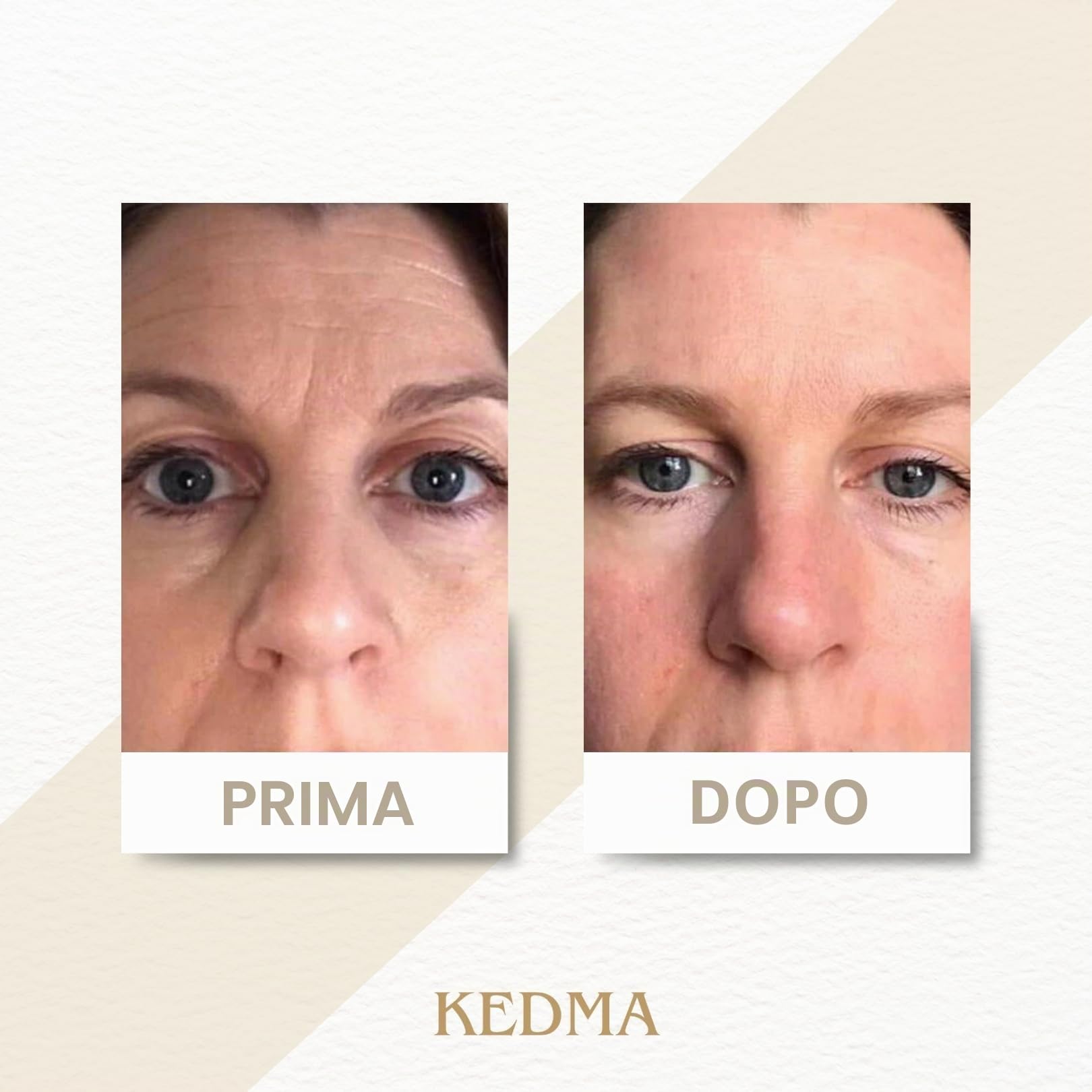 KEDMA - Siero Booster al Collagene Marino e Minerali del Mar Morto - 50g