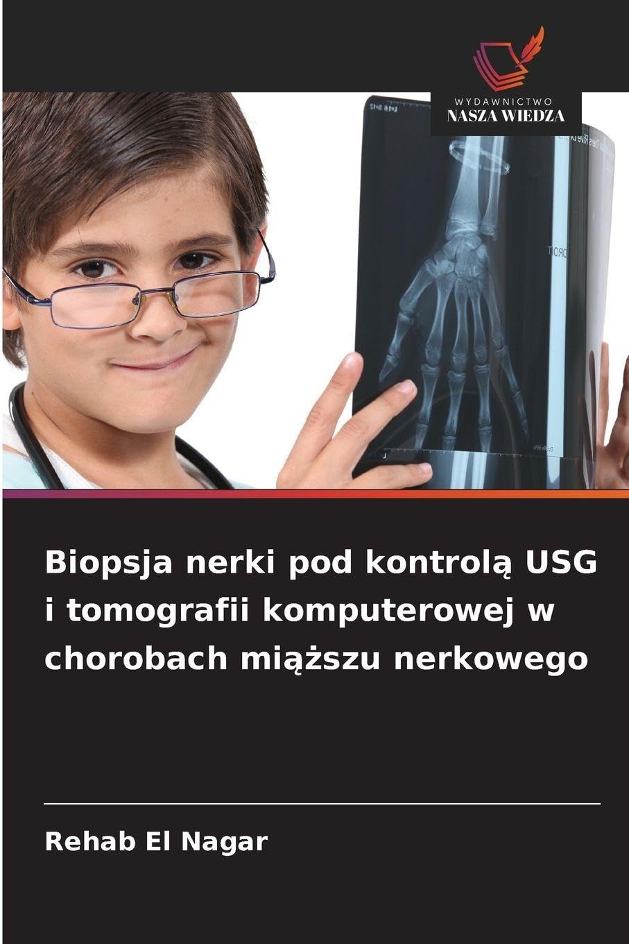 Biopsja nerki pod kontrol¿ USG i tomografii komputerowej w chorobach mi¿¿szu nerkowego