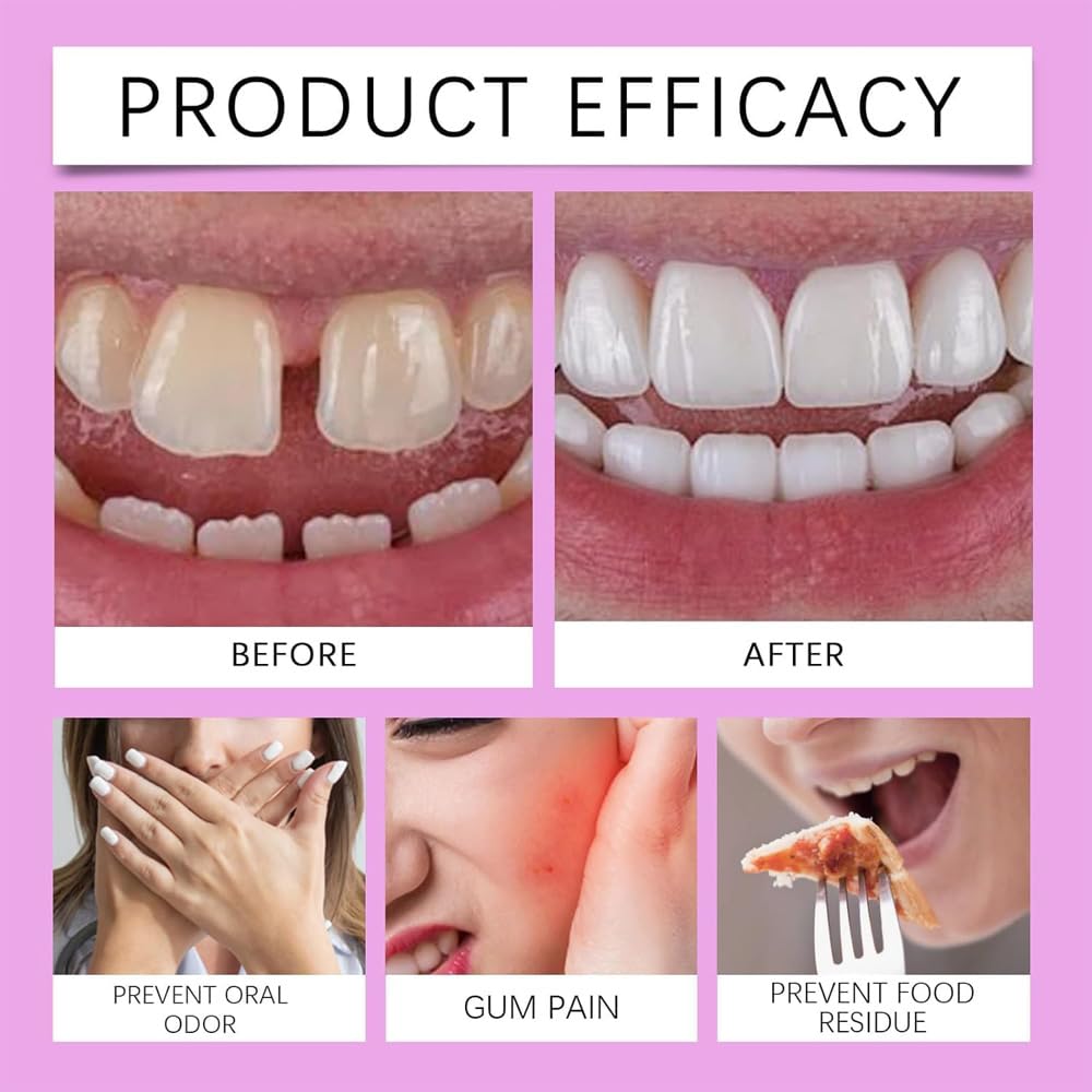 Dentaduras Funcionales, Dentadura Completa Funcional Adaptable, Juego Avanzado De Dentadura Completa De Silicona Personalizada, Para Hombres Y Mujeres (3pcs)
