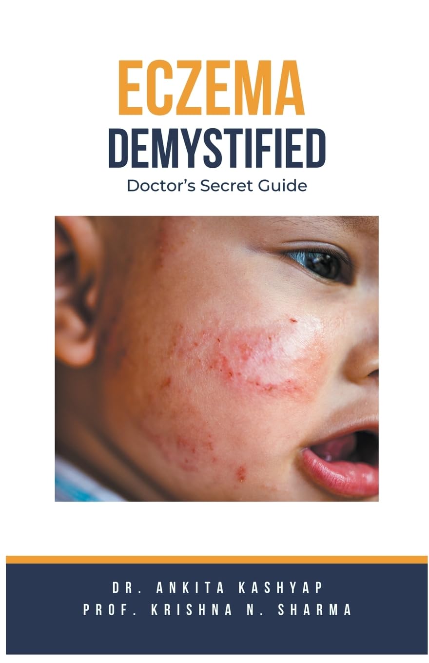 Eczema Demystified: Doctor's Secret Guide