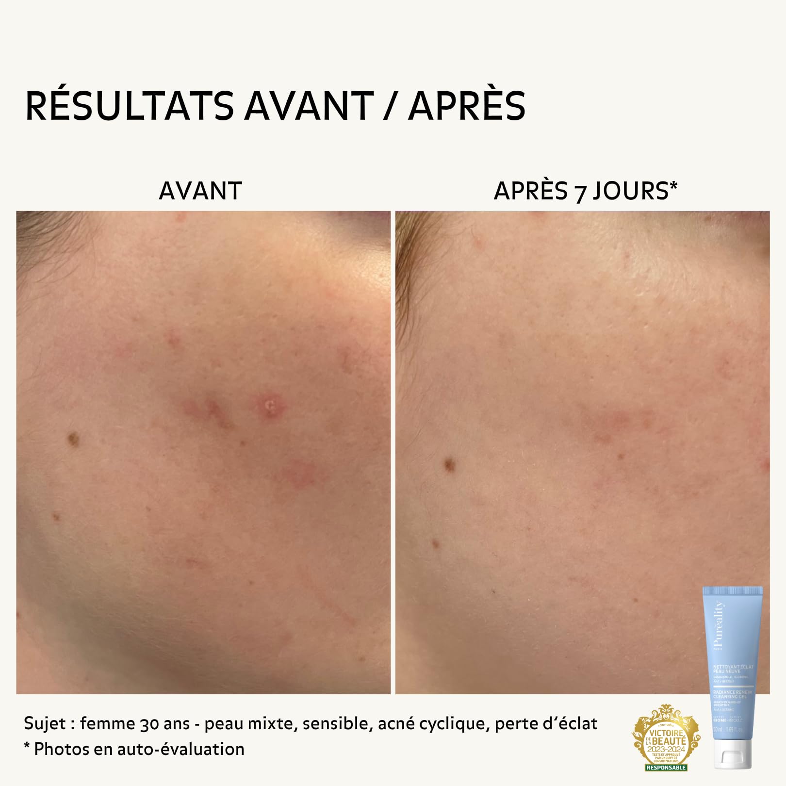 Nettoyant Éclat Effet Peau Neuve 50ml Peau Sensible - Purifie, lisse, illumine & démaquille – aux AHA - Nettoyant visage