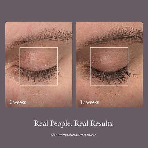 Miniatura 10 de NULASTIN Suero de pestañas - Acondicionador fortificante folículo  Tratamiento potenciador de pestañas con elastina  Promueve la apariencia de