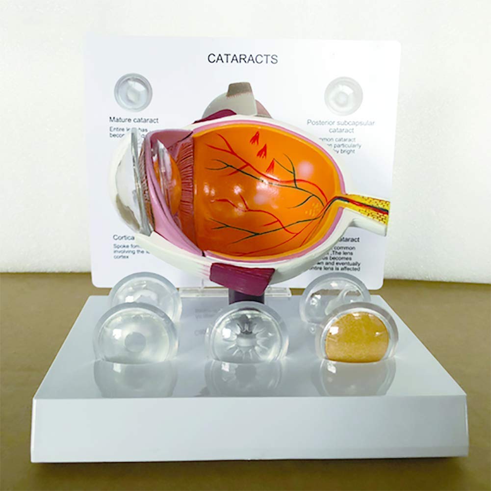 Amazon.co.jp: ModèleAnatomies病気の人間の眼球の祝福の目の