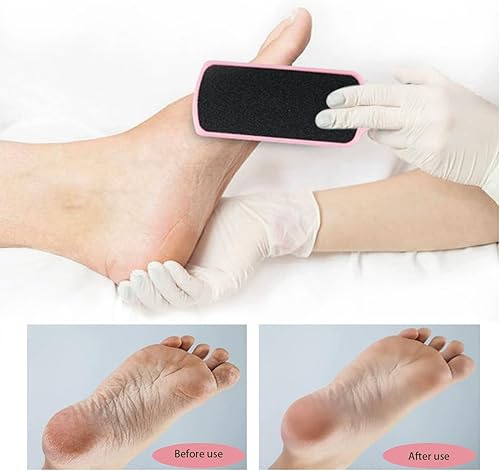Miniatura 2 de BoAn 4 limas de pies para piel muerta, herramientas de pedicura de doble cara, removedor de callos de pies, removedor de piel muerta, herramienta de