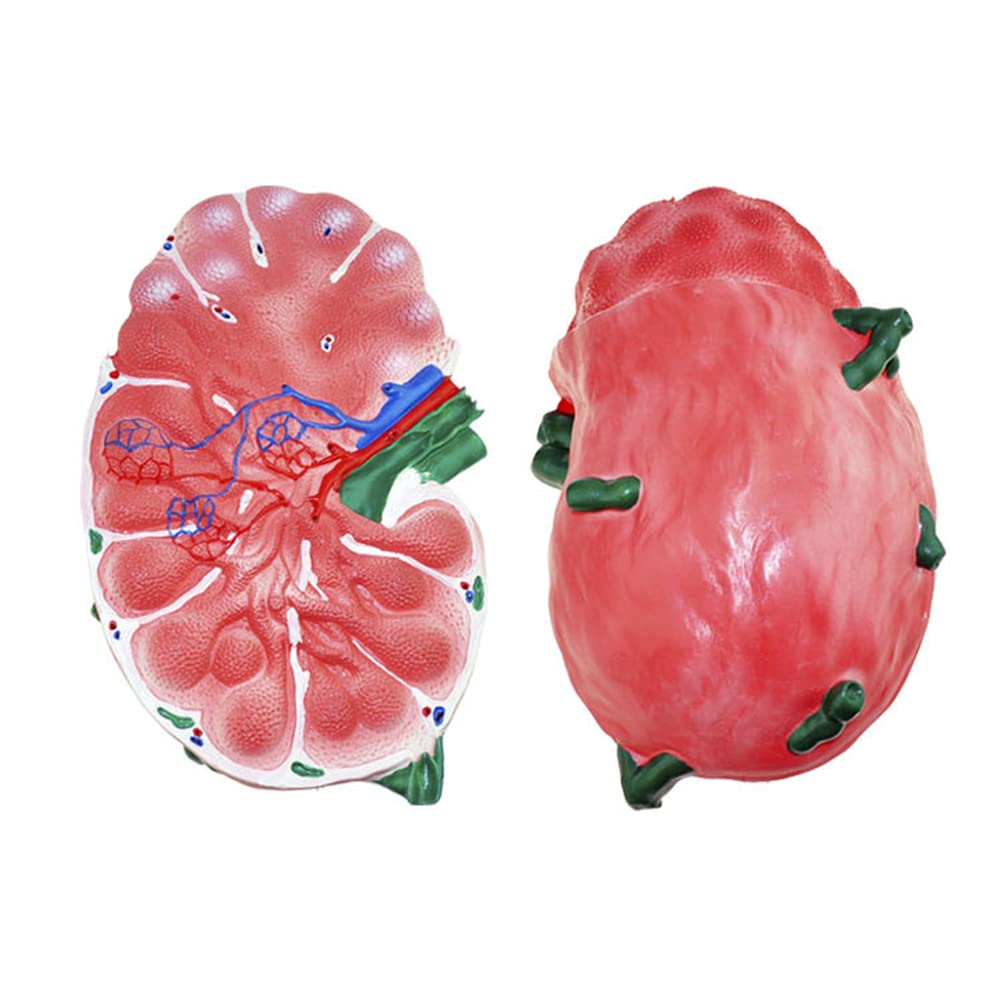 Model powiększania węzłów chłonnych, model anatomiczny narządów ludzkich, model nauczania biologii gimnazjum, materiały medyczne,