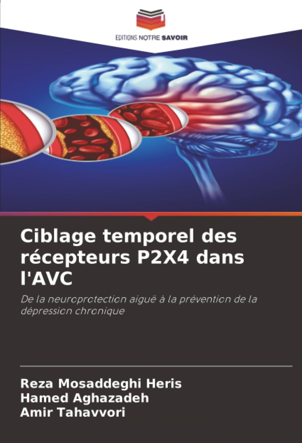 Ciblage temporel des récepteurs P2X4 dans l'AVC: De la neuroprotection aiguë à la prévention de la dépression chronique