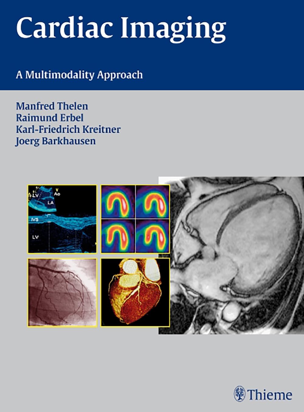 Buy Cardiac Imaging: A Multimodality Approach Book Online at Low
