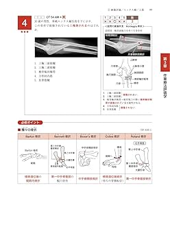 医歯薬出版 作業療法士国試2021 4点セット 第51-55回 理学療法士・作業療法士 国家試験問題 解答と解説