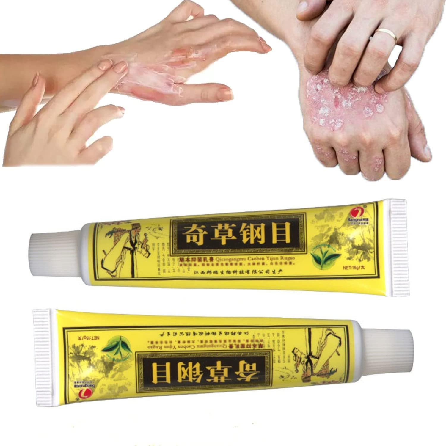 Duhanxi Natural Chinese Herbal Eczema Psoriasis Creams Itchy Skin Fast ...