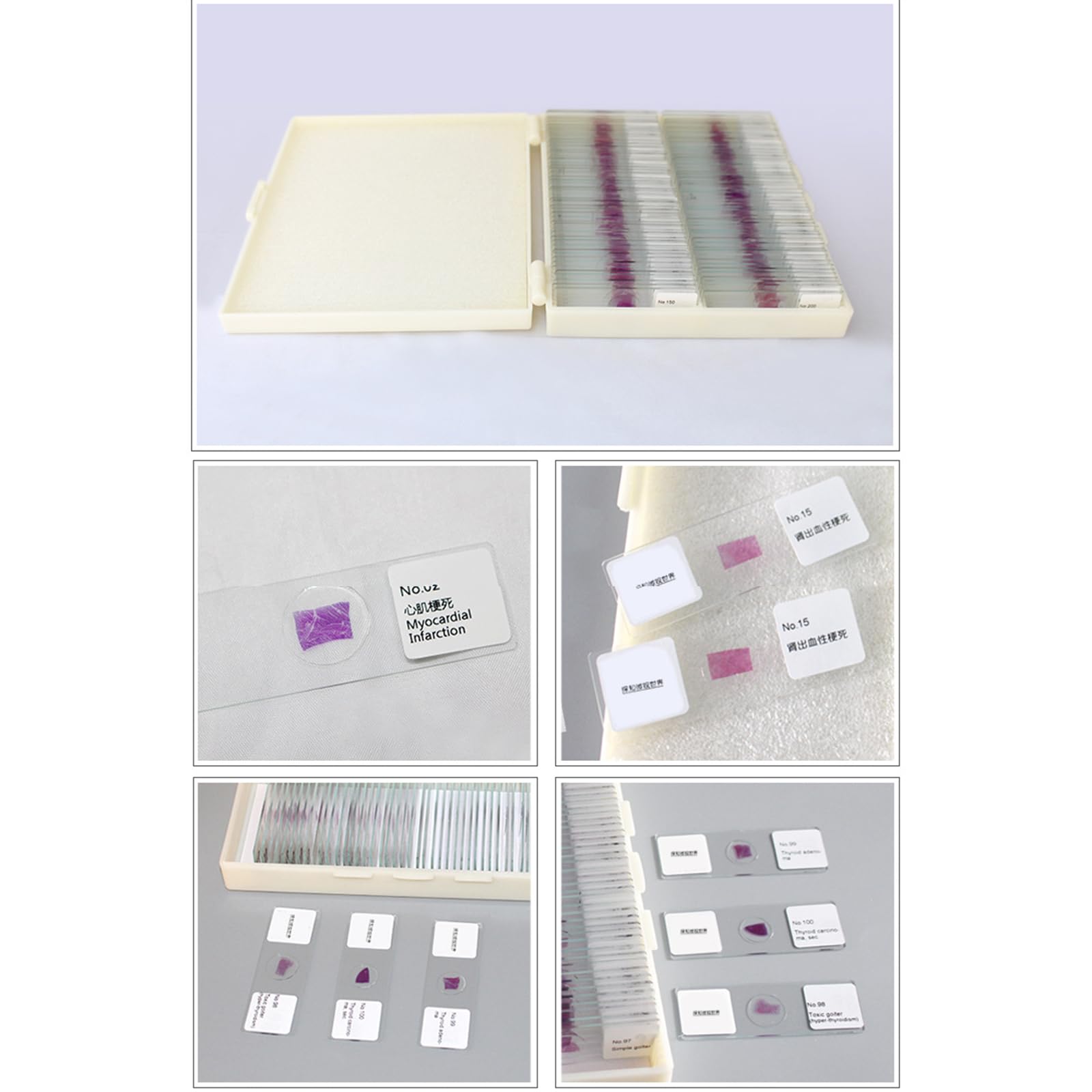 100 Portaobjetos para Microscopio, Portaobjetos De Histopatología con Tinción HE De Células Humanas Estructurales, Transparencia, Teñido Uniforme, Imágenes Claras