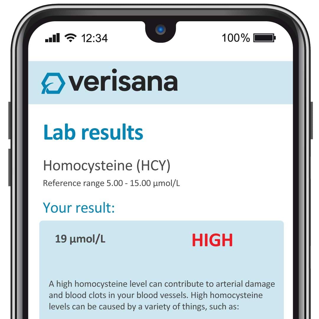Homocysteine Test – Monitor Your Cardiovascular Health – Simple At-Home Testing – Analysis by CLIA-Certified Lab – Verisana