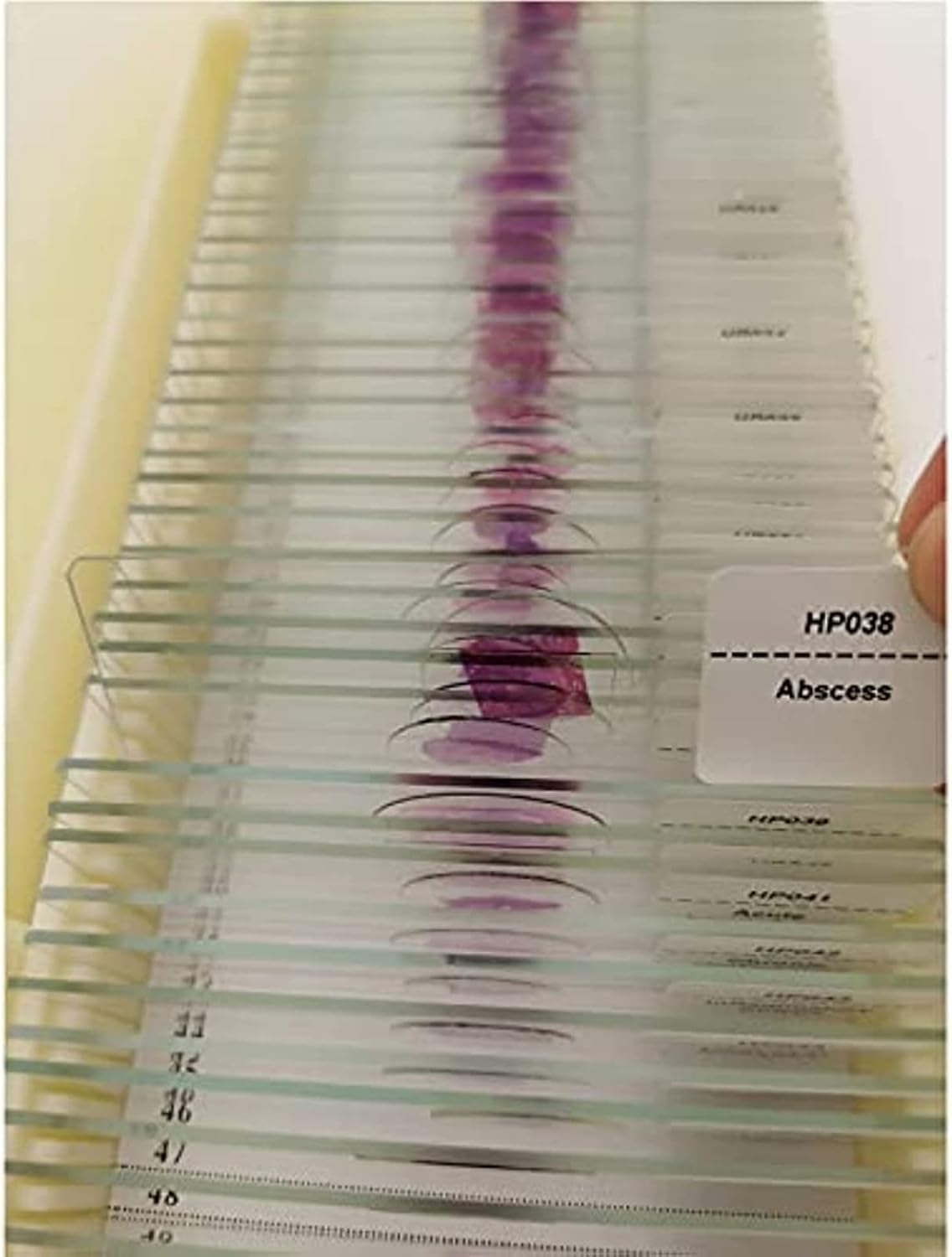 50pcs Hum Patológica Portaobjetos De Microscopio con Muestras, Secciones Patológicas Médicas Portaobjetos De Microscopio, Portaobjetos De Histología para Educación De Estudios Médicos