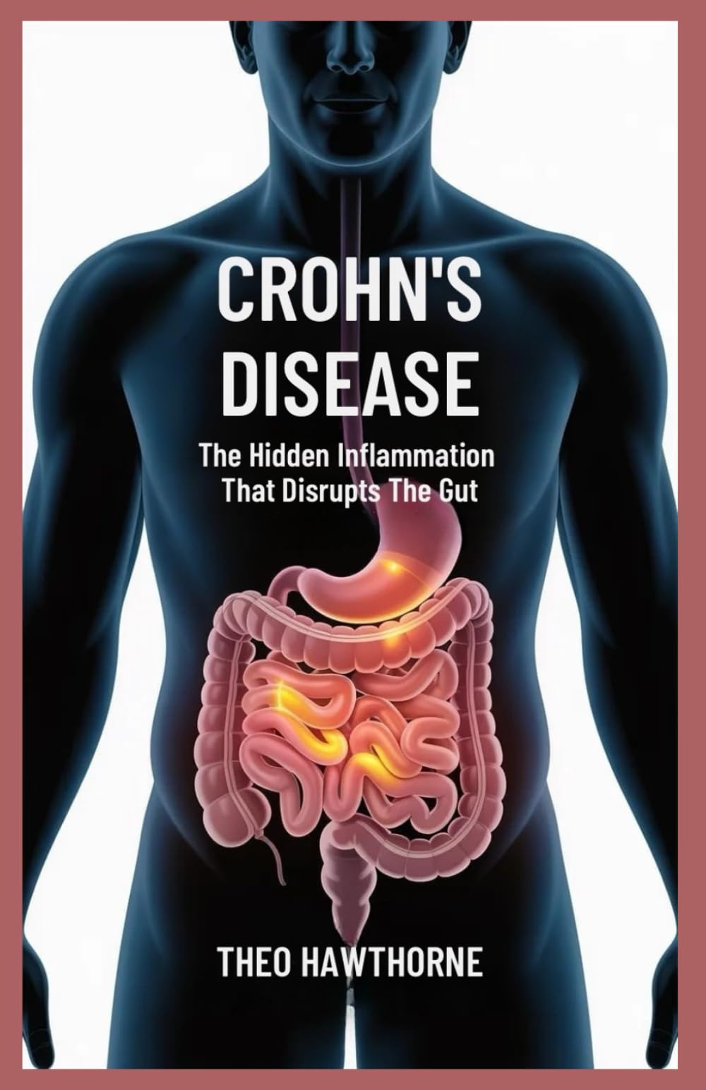 Crohn’s Disease: The Hidden Inflammation That Disrupts the Gut