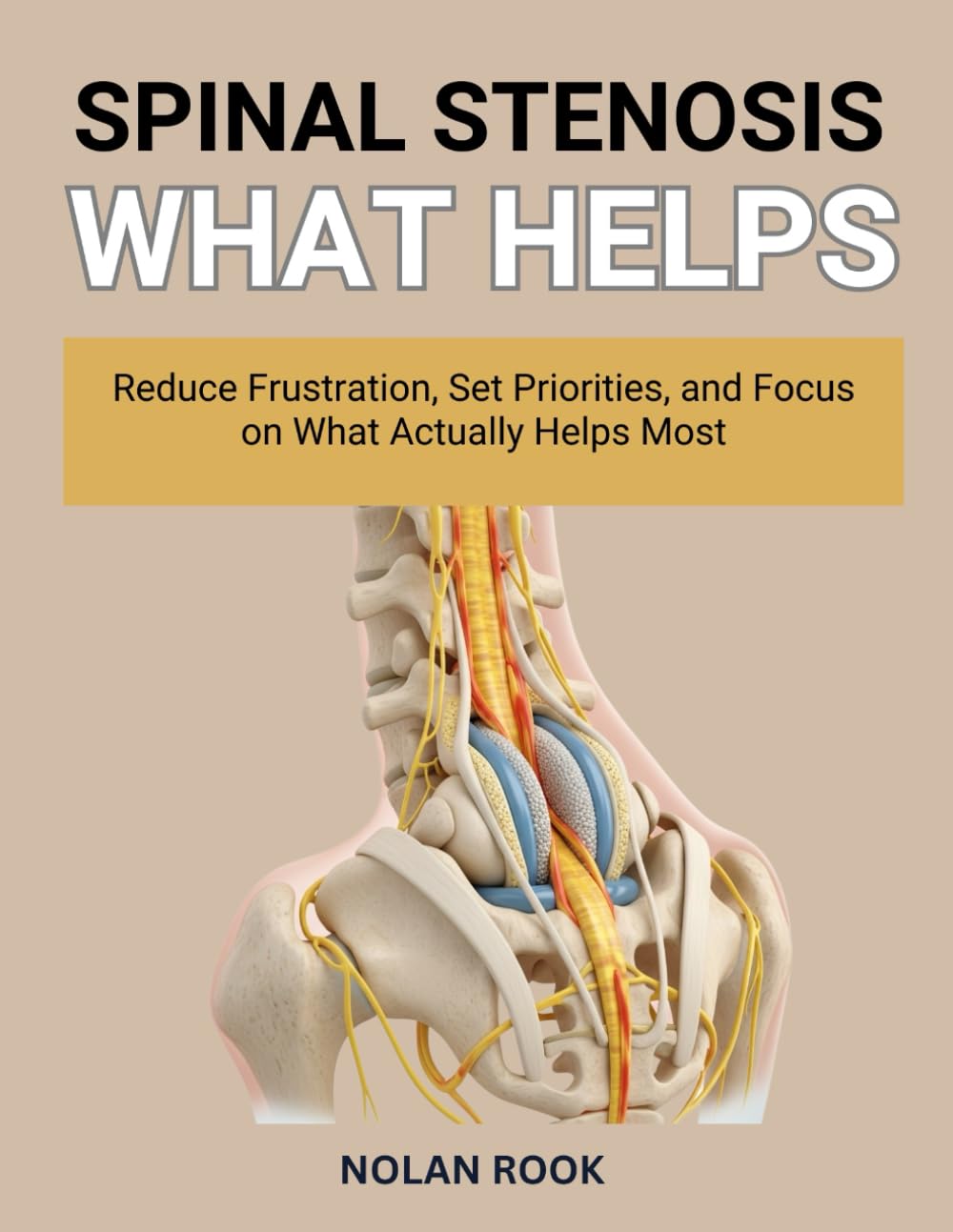 SPINAL STENOSIS WHAT HELPS: Reduce frustration, set priorities, and focus on what actually helps most.