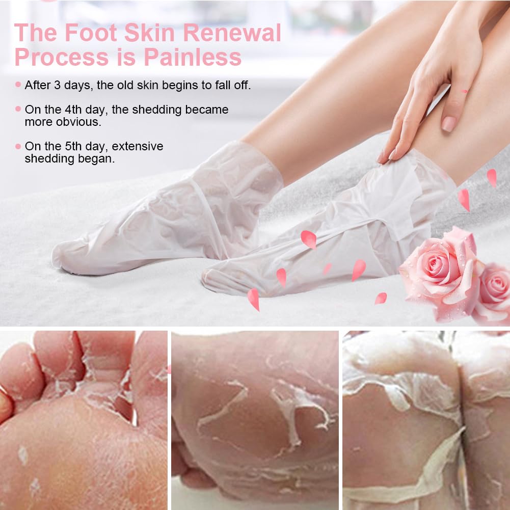 Masque Pieds Peeling Exfoliant, 4 Paires Masque Pieds Hydratant Exfoliant Saveur Rose, Masque Peeling pour les Pieds, Chaussette Exfoliante, pour Nourrissant Callosités, Crevasses et Pieds Secs