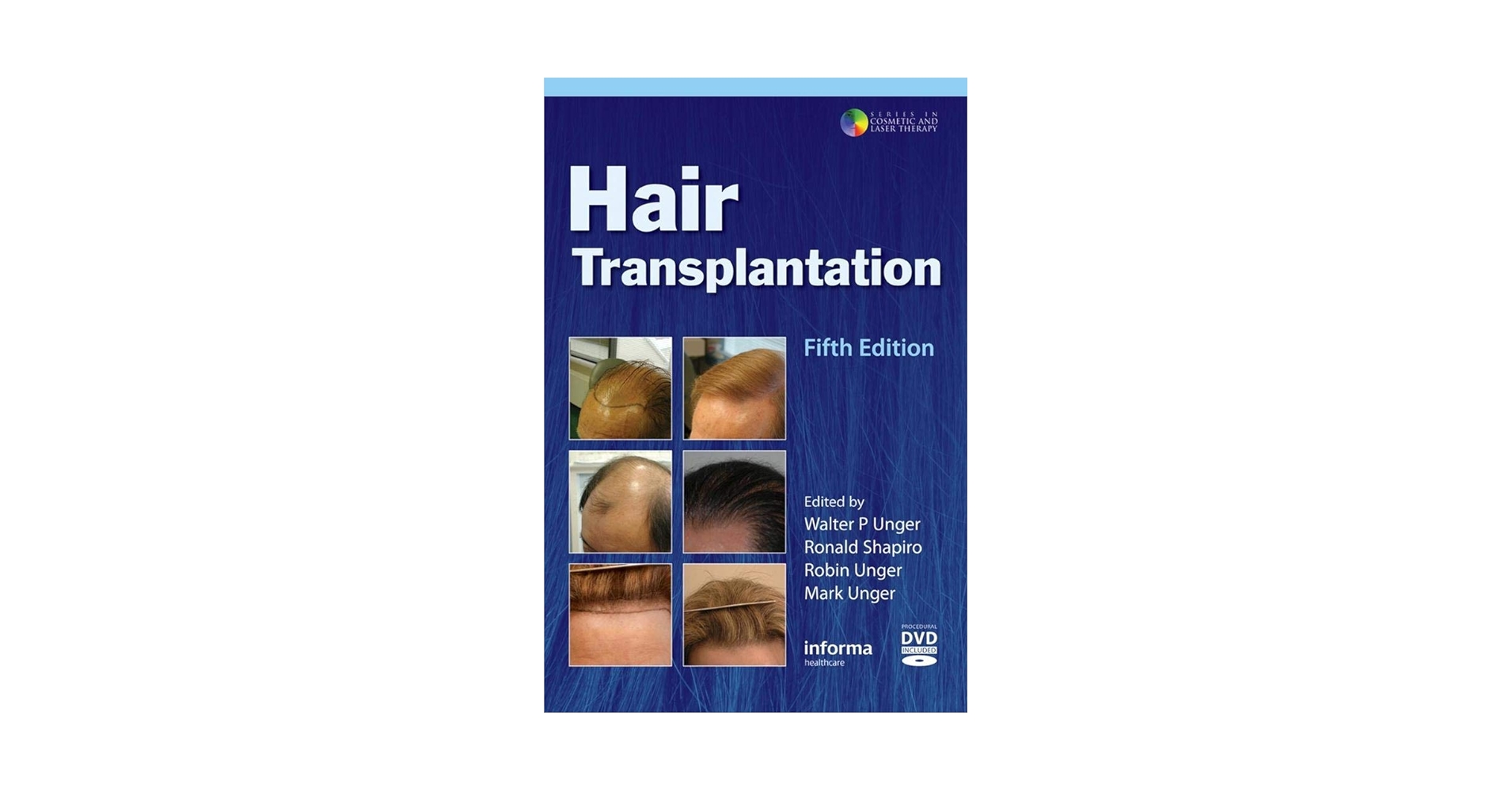 Hair Transplantation Fifth Edition（洋書） 6163O8Bh1ZL._UF350,350_QL50_.jpg