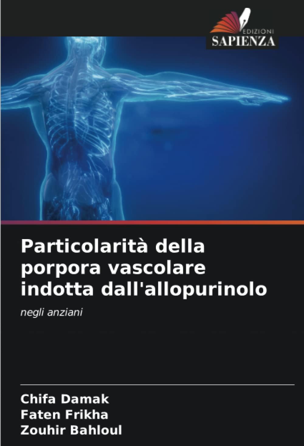 Particolarità della porpora vascolare indotta dall'allopurinolo: negli anziani