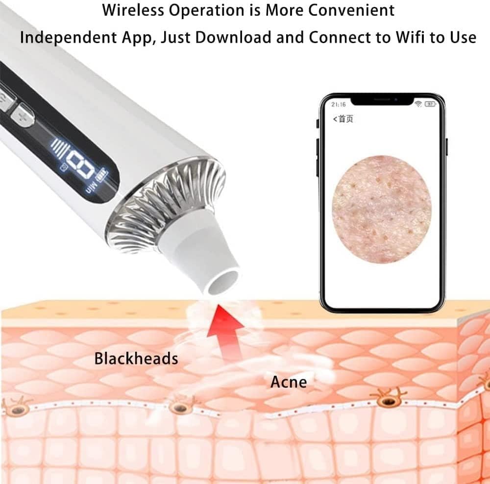 L'ultimo pulitore elettrico for pori con aspirapolvere for la rimozione dei punti neri, adatto for donne e uomini, misuratore di punti neri con estrattore di punti neri ricaricabile tramite USB