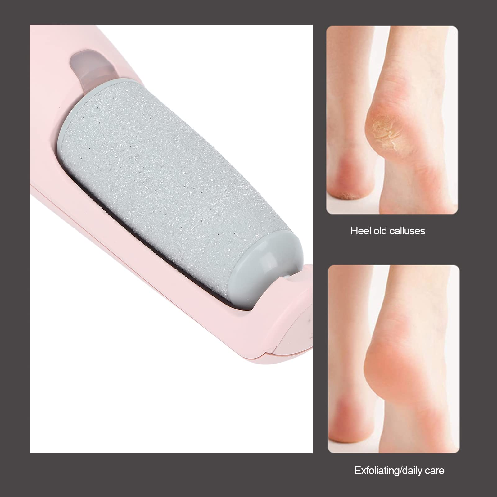 Electric Foot Callus And Hard Skin Remover - Rechargeable Foot Callus