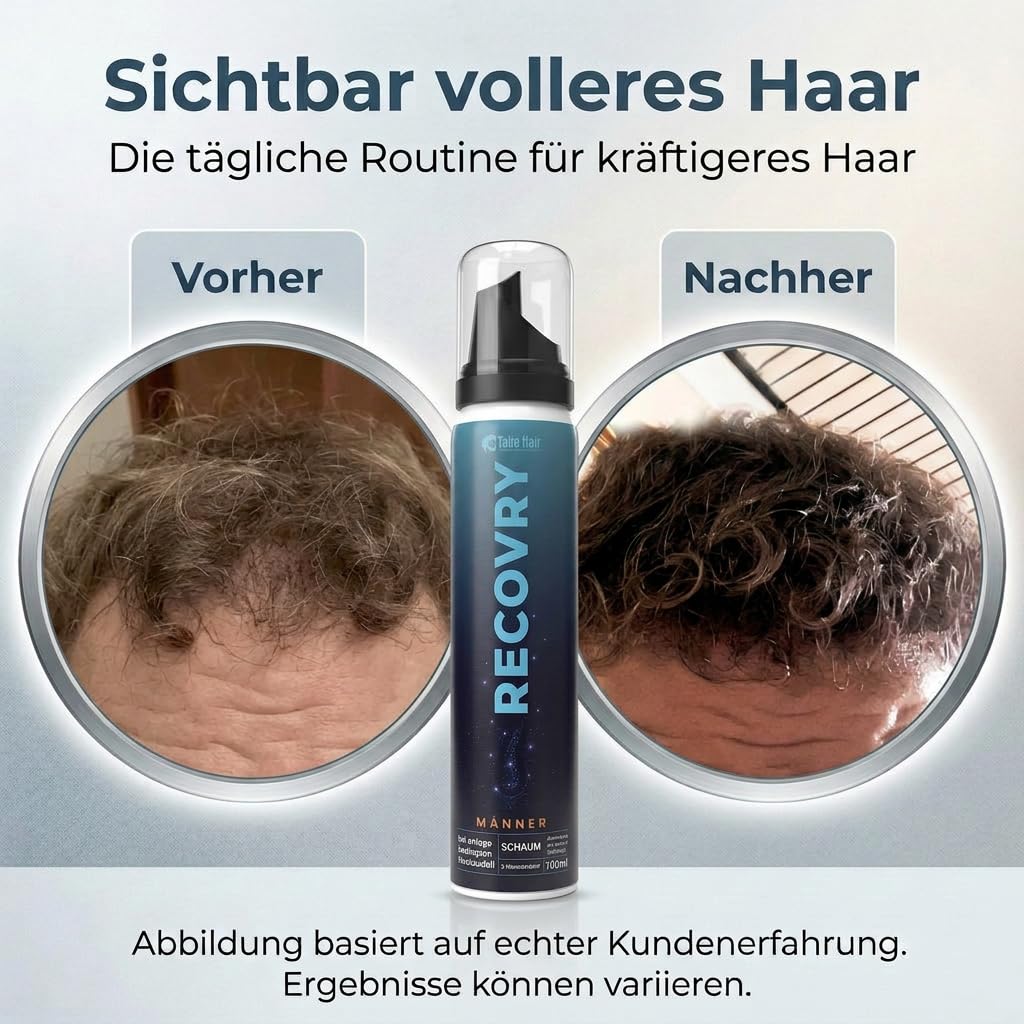 RECOVRY Haarwuchsmittel Männer mit Redensyl & Procapil - 100ml (2 Monate) Hair Loss Treatment gegen Haarausfall Mann, Geheimratsecken & DHT Blocker Haarausfall - kombinierbar mit Minoxidil