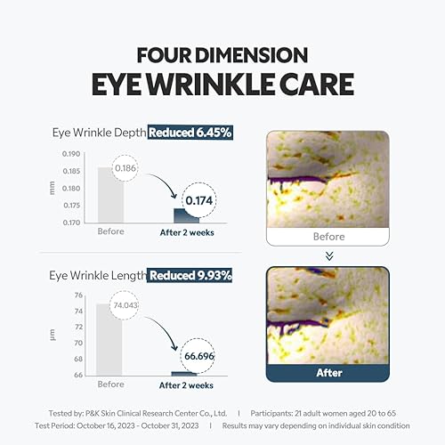Miniatura 6 de TIRTIR - Crema para contorno de ojos con colágeno y aplicador de rodillo, tratamiento para arrugas localizadas, hidratante revitalizante, tensado