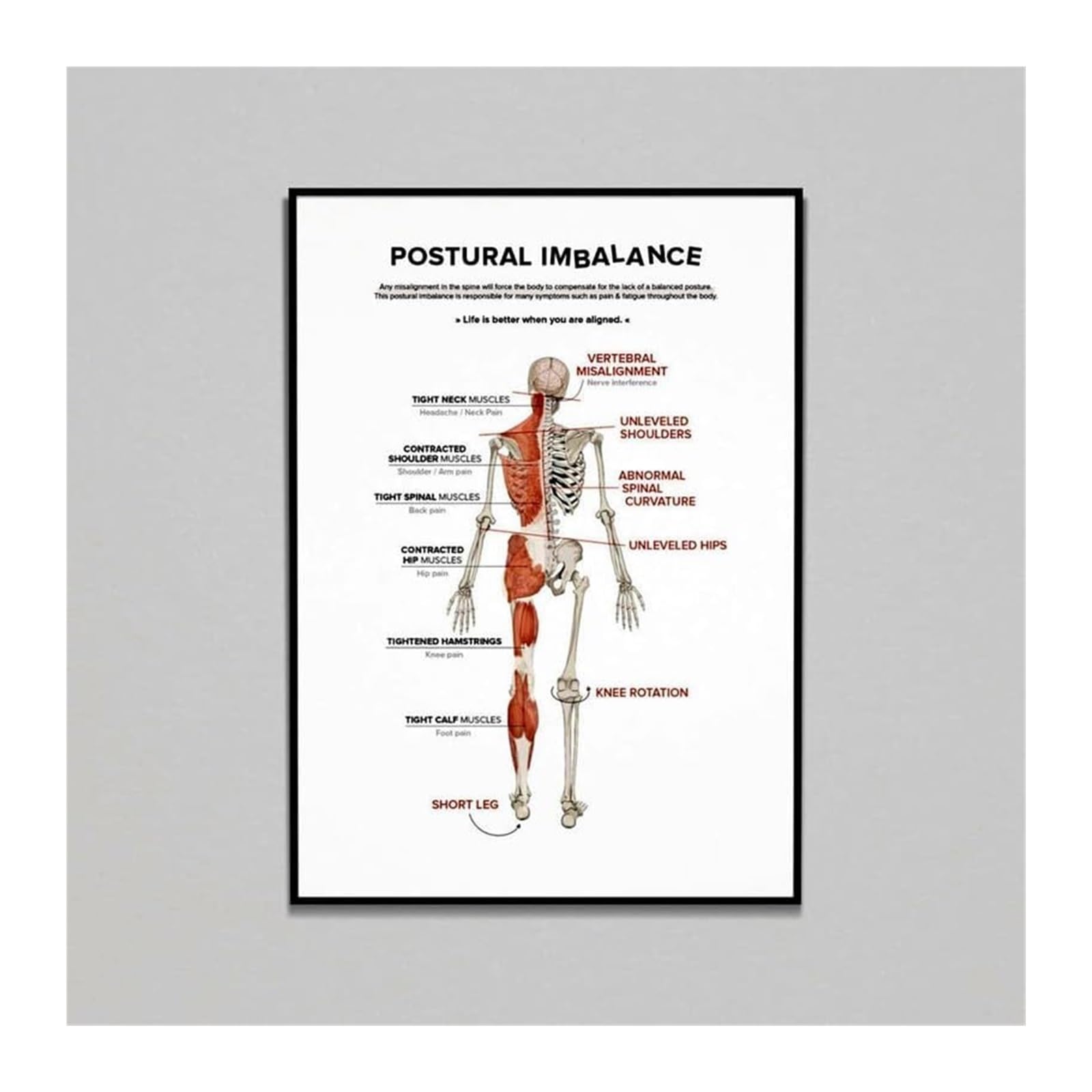 AUOQKQUT Chiropractic Posture Chart Spinal Alignment and Imbalance Diagram Educational Canvas Wall-Art for Office Framed,08x12inch(20x30cm)
