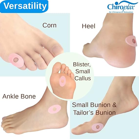 Chiroplax Bundle - 36 Foam Callus Cushions + 45 Foam Corn Cushions