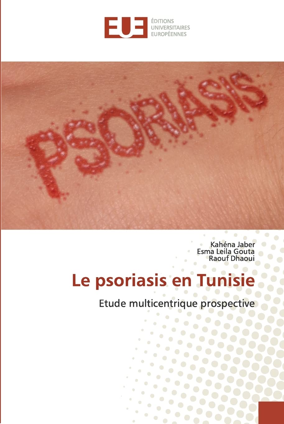 Le psoriasis en Tunisie: Etude multicentrique prospective (French Edition)