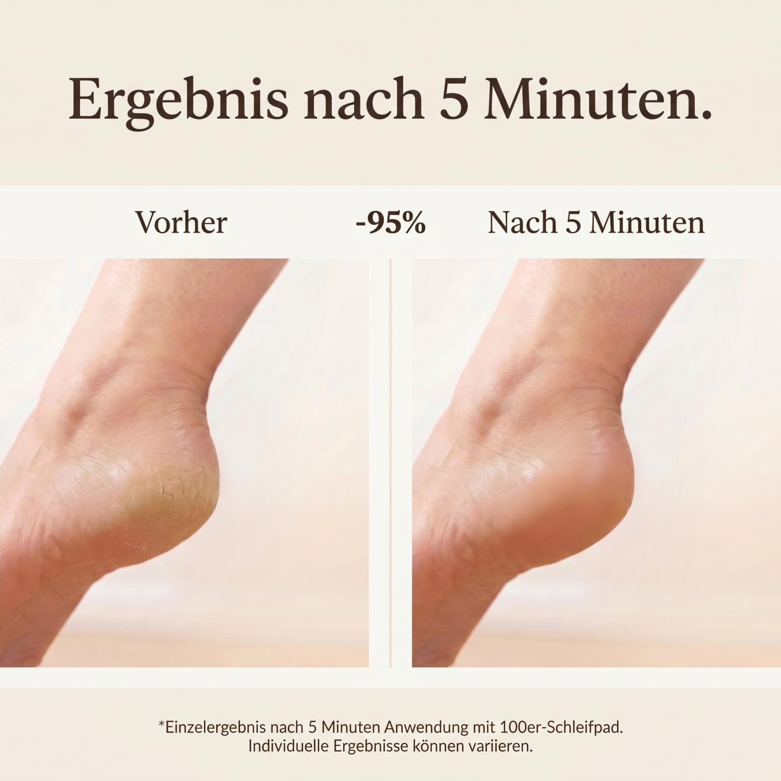 Dermaglide Hornhaut Entferner 2.0,Elektrischer Hornhautentferner,Geschwindigkeit einstellbar mit 60+10 austauschbaren Schleifscheiben,Nagelschleifer & Fußpflegeset für zu Hause