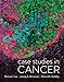 Case Studies in Cancer
