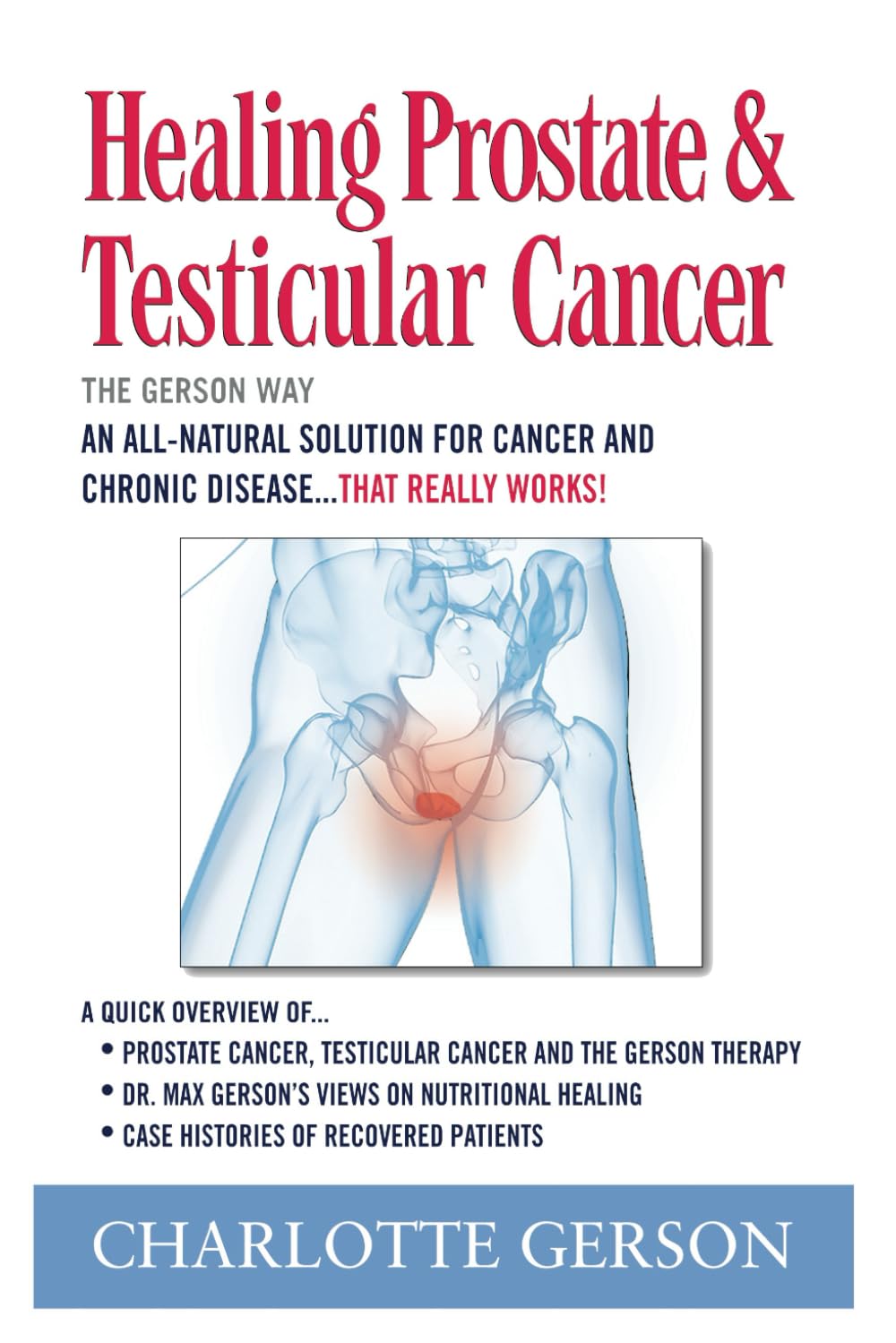 Healing Prostate & Testicular Cancer: The Gerson Way