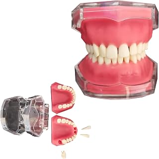 Dental Extraction Model,Full Mouth Resin Dental Model, for Practice Communication Clinic Ornaments Dental Teaching Aids