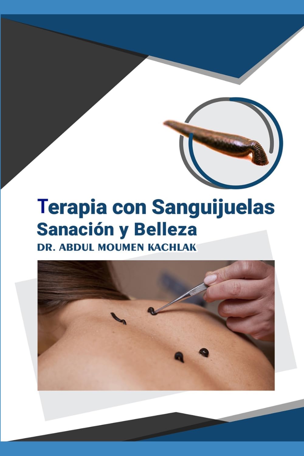 Terapia con Sanguijuelas Sanación y Belleza: Hirudoterapia Avanzada: Bases Científicas y Aplicaciones Clínicas